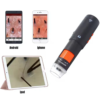 WiFi Microscope with Skin and Mole Analysis - Asset Track Pro
